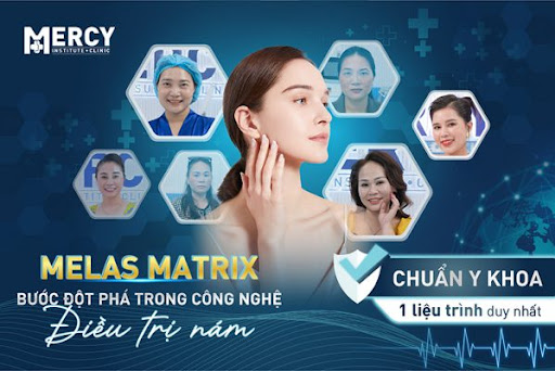 Khám phá công nghệ Melas Matrix - 'khắc tinh' nám lâu năm, chân sâu tại Phòng khám Mercy